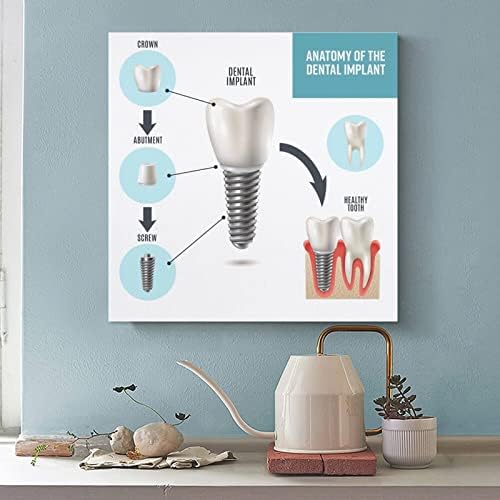 Заби за стоматолошки имплантација на стоматолошки постер за стоматолошка клиника постери за сликање постери и отпечатоци од wallидни