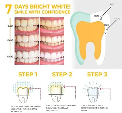 Белење на серумот на забите, серумскиот гел за белеење на забите, ефективниот отстранувач на дамки на забите до белење на забите, грижа за чистење на забите, погодна