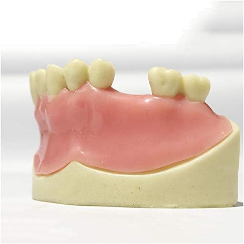 Модел на настава на заби на лемита - Максиларен модел на заби што недостасува - Студија за заби на заби