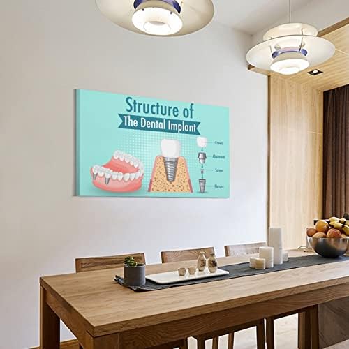 Заби за стоматолошки имплантација на стоматолошки постер за стоматолошка клиника постери за сликање постери и отпечатоци од wallидни уметности за дневна соба декор