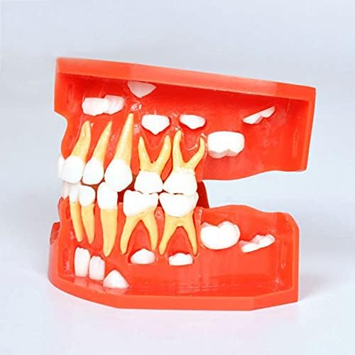 KH66ZKY Model Model - 3-6 години деца на листопадни и постојани заби наизменичен модел на заби - за екранот на училишно образование или образование на пациенти