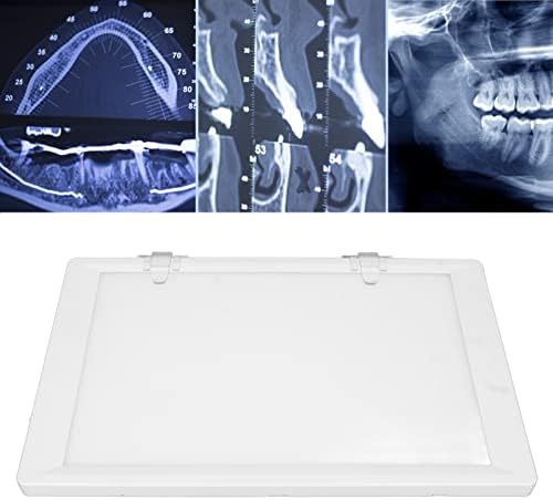 Рентген Дисплеј Светилка, Стоматолошки Рендген Гледање Светилка, Кт Набљудување Светилка, Прилагодување На Бојата Осветленост
