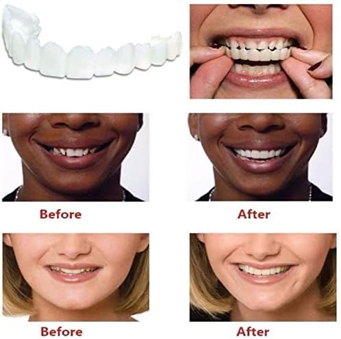 Заби за протези 2 парчиња - заби на фурнир - за привремена поправка на забите горно и пониско