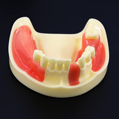 Практика за заби за заби за заби модел на типодонт предостава за реставрација Демо за студии Научете пониска вилица отстранлива