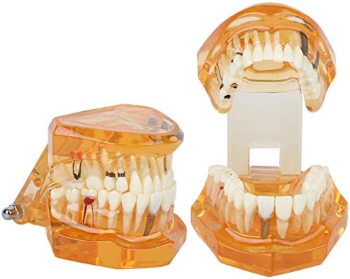 Алемо Хуангксинг - Образование на забите, Научете демо стоматолошки модел, патолошка анатомија портокалова за стоматолошки училишта правни презентации