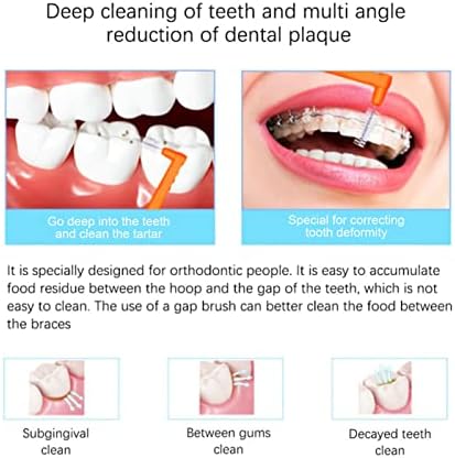 Фдит 5 парчиња Интердентални Четки Во Форма На Л За Ефикасно Чистење На Плаките И Отстранување На Протезите Погодни За Нега На Забите