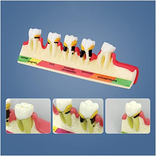 Модел за класификација на заби KH66ZKY, модел на заби за заби, за модел на приказ на комуникација со лекар-пациент