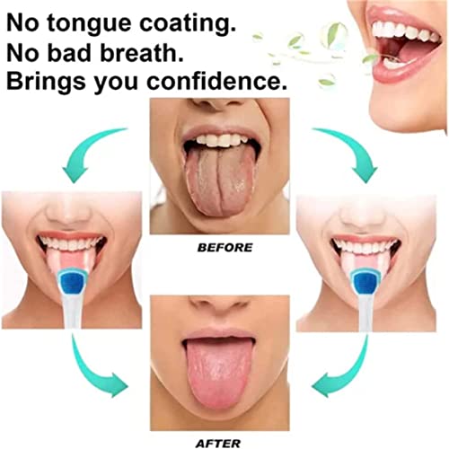 2023 Нов гел за чистење на пробиотик јазик, сет, гел за чистење на орална хигиена и гел за чистење на јазик, гел за чистење на пробиотик јазик