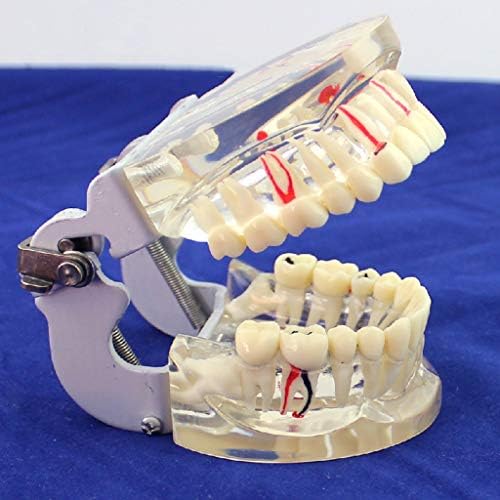 Модел на заби за заби на заби на лемита за заби - модел на имплантација на заби - транспарентен модел за демонстрација на сеопфатна орална