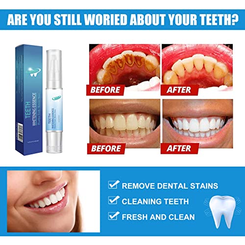 Пенка за белење на заби, 5 парчиња заби за заби заби за белење на заби за отстранување на дамки од заби, гел за белење на карбамид пероксид,