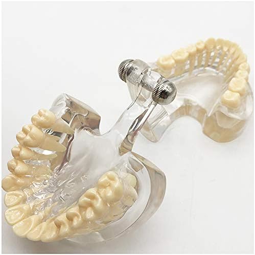 Модел на заби на забите KH66ZKY - Студија за заби за заби