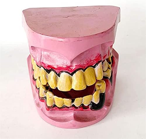 Модел на настава RRGJ, модел на заболени заби - Заеднички модел на одонтологија на човечки пушачи Патолошки заб Орален модел - Орална грижа